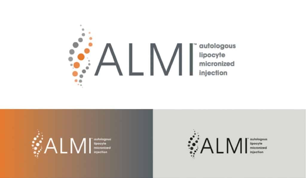 Logo Design - Almi